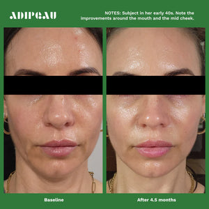 Adipeau Volume Cream Results