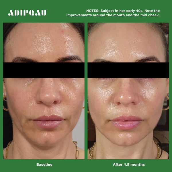 Adipeau Volume Cream Results